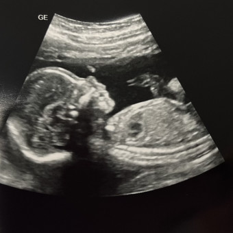 Babylist Registry Photo.