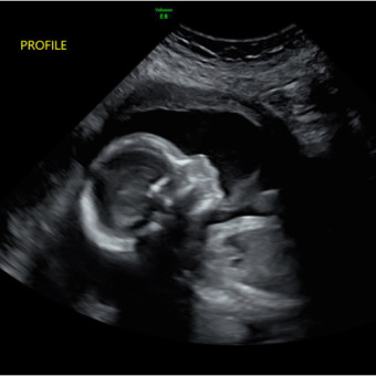 Babylist Registry Photo.