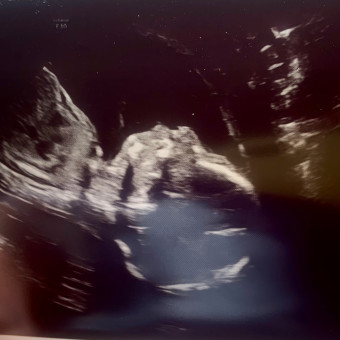 Babylist Registry Photo.