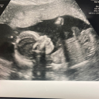 Babylist Registry Photo.
