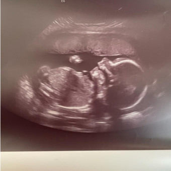 Babylist Registry Photo.