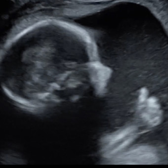Babylist Registry Photo.