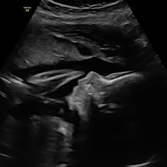 Babylist Registry Photo.