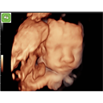 Babylist Registry Photo.