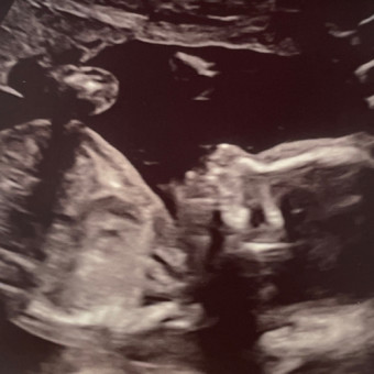 Babylist Registry Photo.