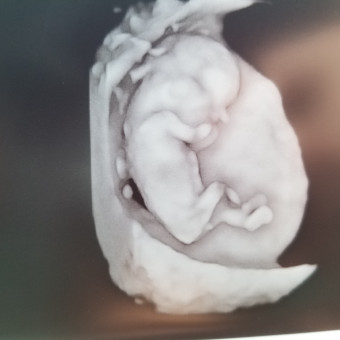 Babylist Registry Photo.
