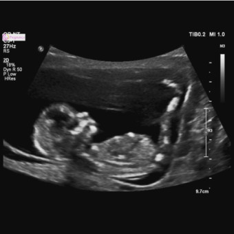 Babylist Registry Photo.
