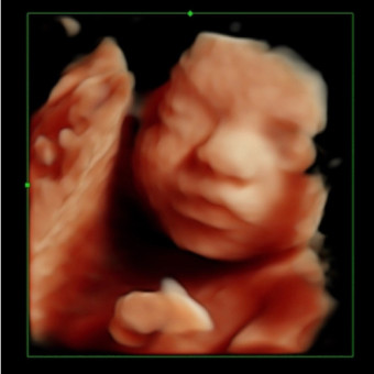 Babylist Registry Photo.