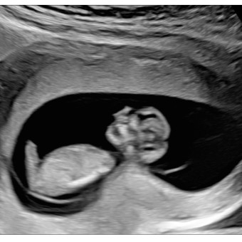 Babylist Registry Photo.