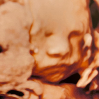 Babylist Registry Photo.
