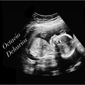 Babylist Registry Photo.