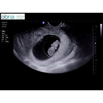 Babylist Registry Photo.