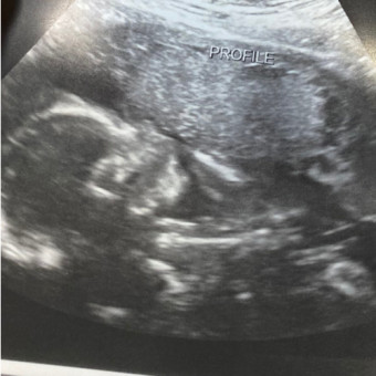 Babylist Registry Photo.