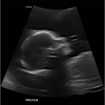 Babylist Registry Photo.