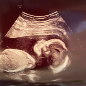 Babylist Registry Photo.