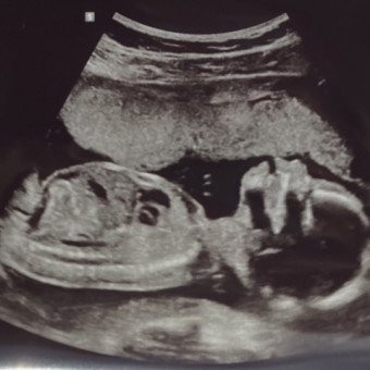 Babylist Registry Photo.