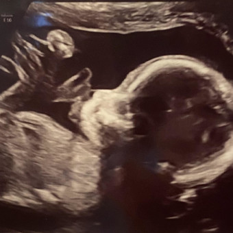 Babylist Registry Photo.
