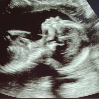Babylist Registry Photo.