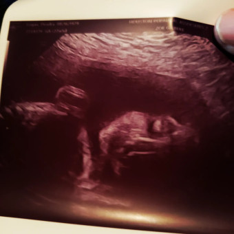 Babylist Registry Photo.
