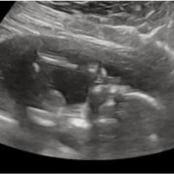 Babylist Registry Photo.