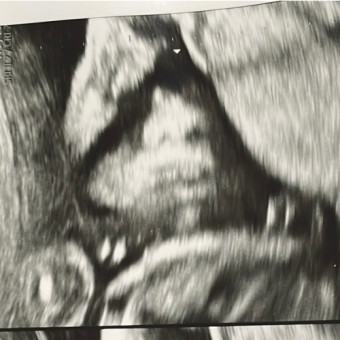 Babylist Registry Photo.
