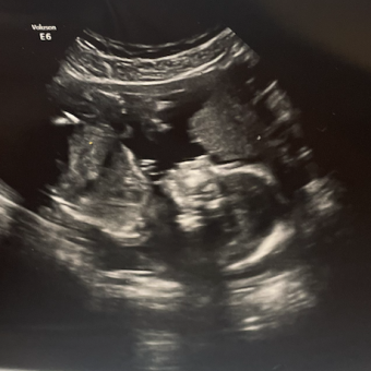 Babylist Registry Photo.
