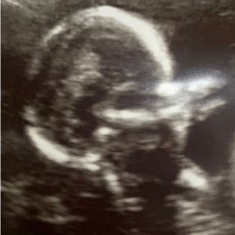 Babylist Registry Photo.