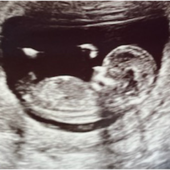 Babylist Registry Photo.