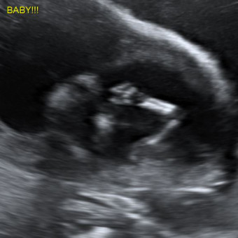 Babylist Registry Photo.
