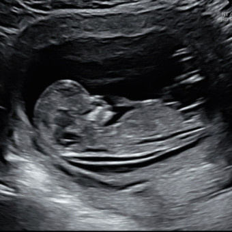 Babylist Registry Photo.