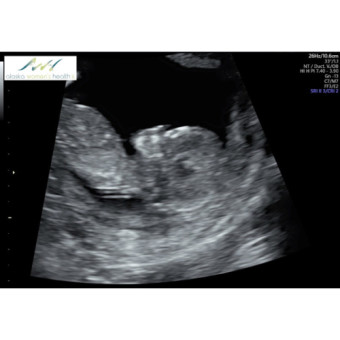 Babylist Registry Photo.
