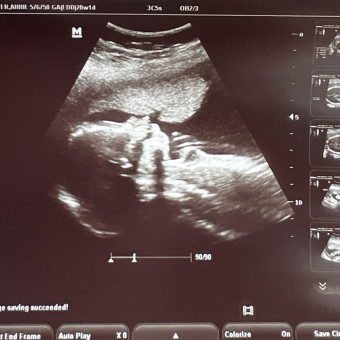 Babylist Registry Photo.