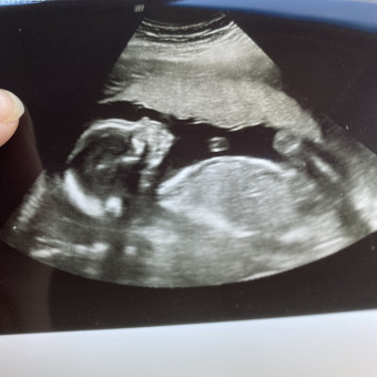 Babylist Registry Photo.