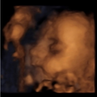 Babylist Registry Photo.