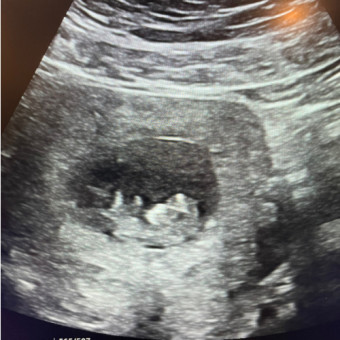 Babylist Registry Photo.