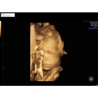 Babylist Registry Photo.
