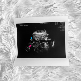 Babylist Registry Photo.