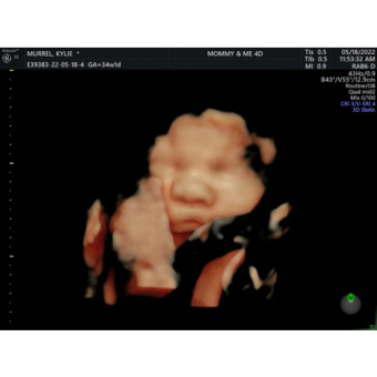Babylist Registry Photo.
