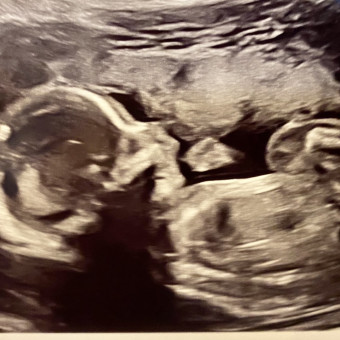 Babylist Registry Photo.