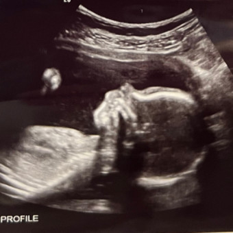 Babylist Registry Photo.