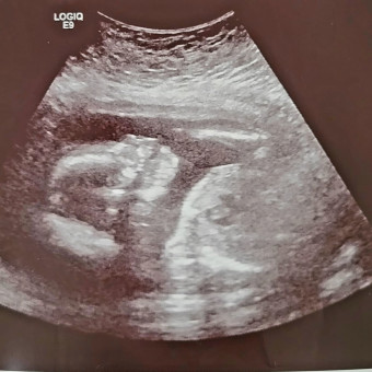 Babylist Registry Photo.
