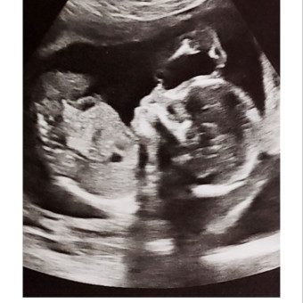 Babylist Registry Photo.