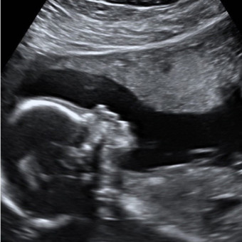 Babylist Registry Photo.