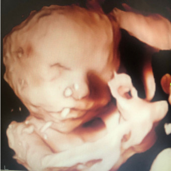 Babylist Registry Photo.