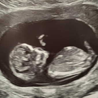Babylist Registry Photo.