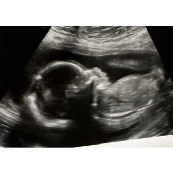 Babylist Registry Photo.