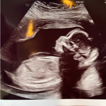 Babylist Registry Photo.