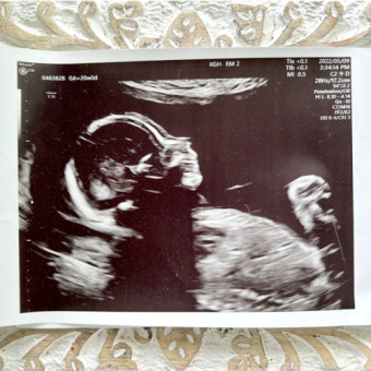 Babylist Registry Photo.