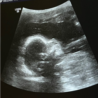 Babylist Registry Photo.