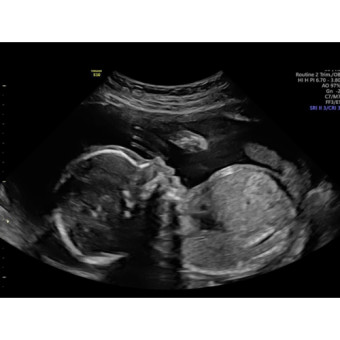 Babylist Registry Photo.